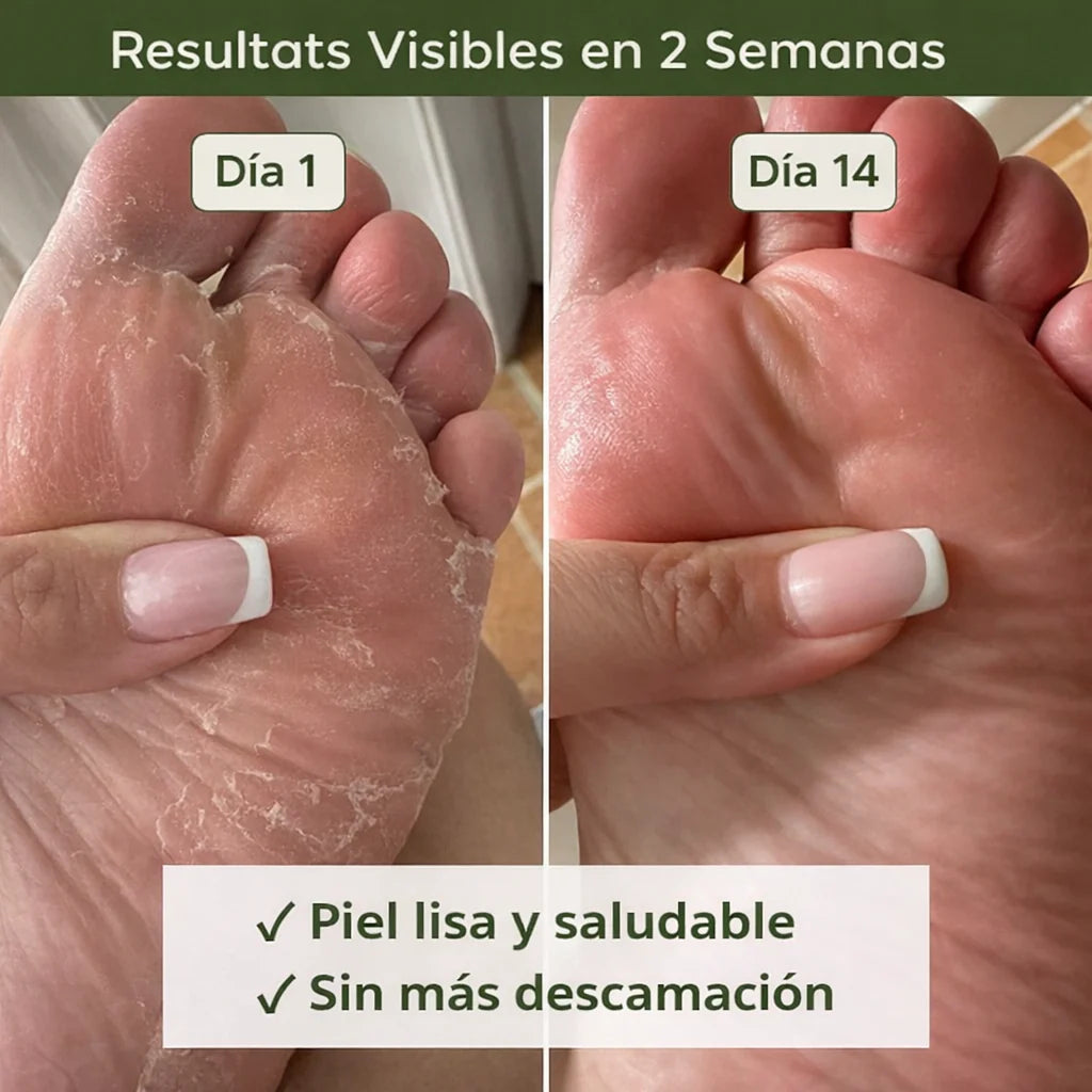 Vertmeé - Jabón Purificante Antimicótico